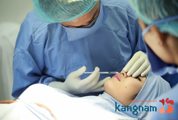 Quy trình nâng mũi s line được thực hiện như thế nào tại Kangnam?